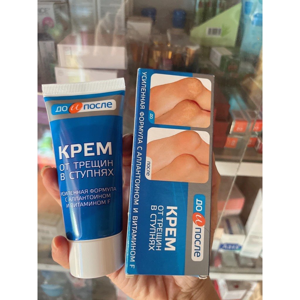 Kem Nứt Gót Chân Nga