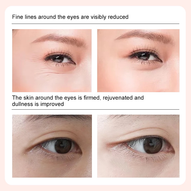 Set 10 cặp mặt nạ mắt MeiYanQiong chiết xuất thành phần ngọc trai đen dưỡng ẩm chăm sóc vùng da quanh mắt hiệu quả