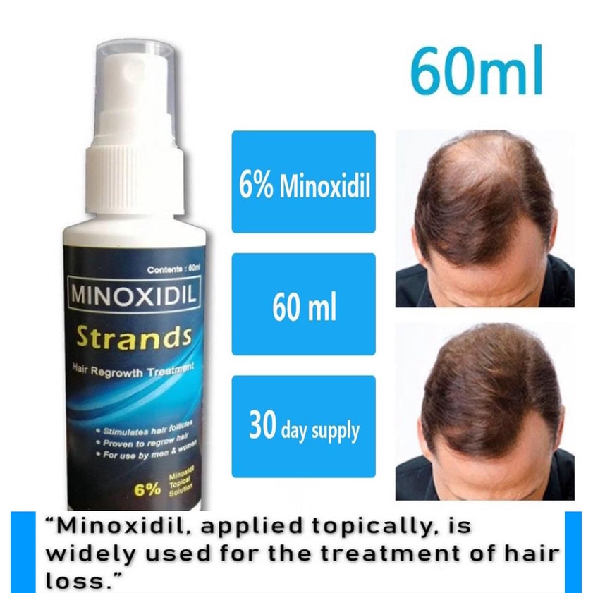 Chai Xịt Kích Thích Mọc Tóc minoxidil 6%