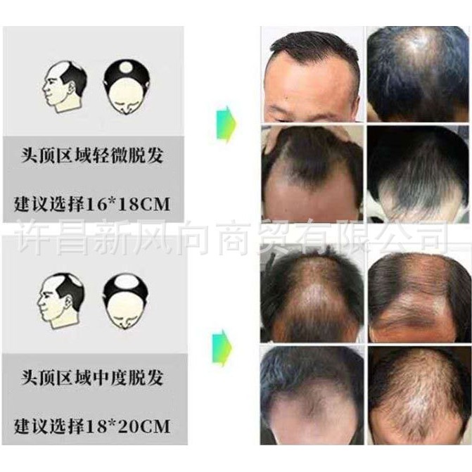 Tóc Giả Ngắn Màu Nâu Tự Nhiên 100% Tóc Mái Ngang Cho Nam Giới