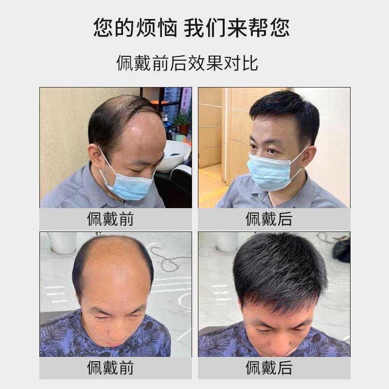 Bộ Tóc Giả Ngắn Tự Nhiên Màu Đen Cá Tính Cho Nam
