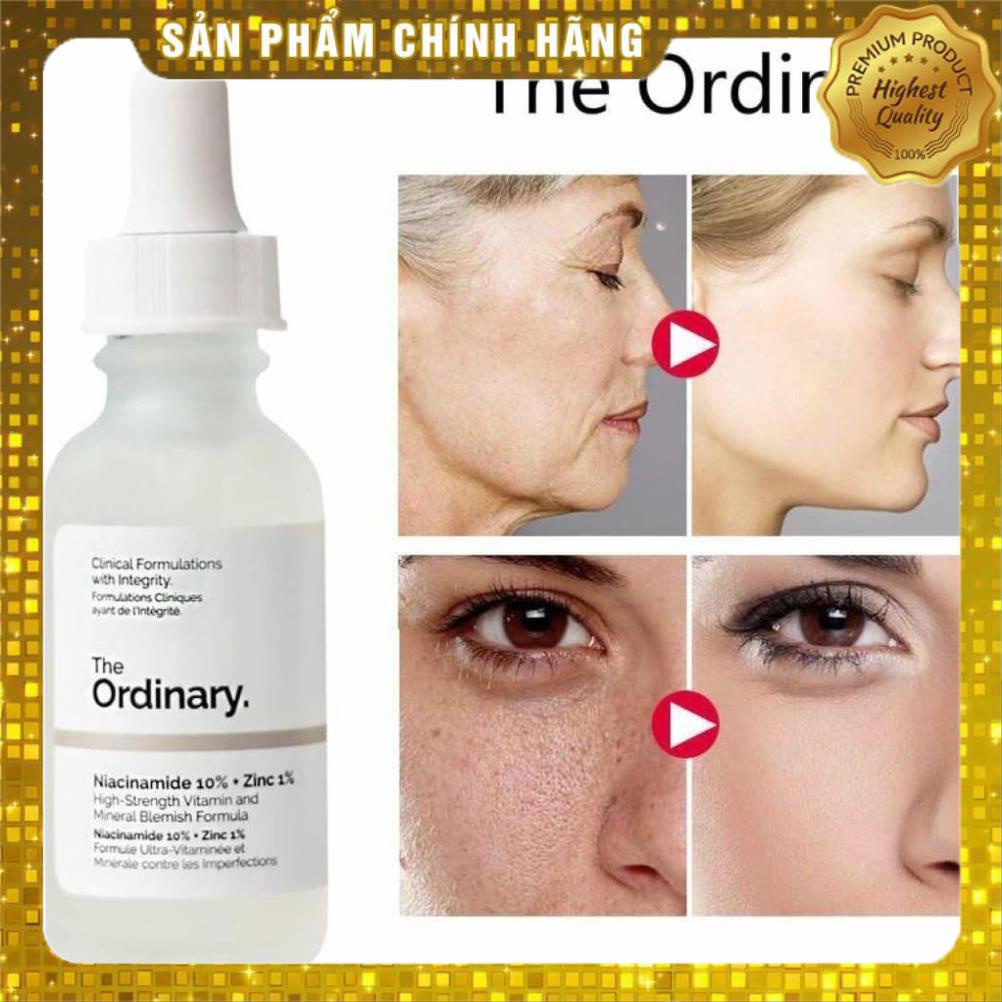Tinh chất Serum The Ordinary Niacinamide 10% + Zinc 1% siêu dưỡng da ⭐