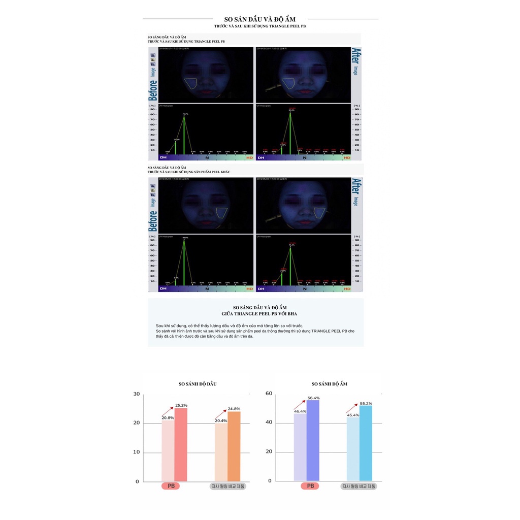 Peel da dầu, mụn Ahohaw Triangle Peel PB  chính hãng