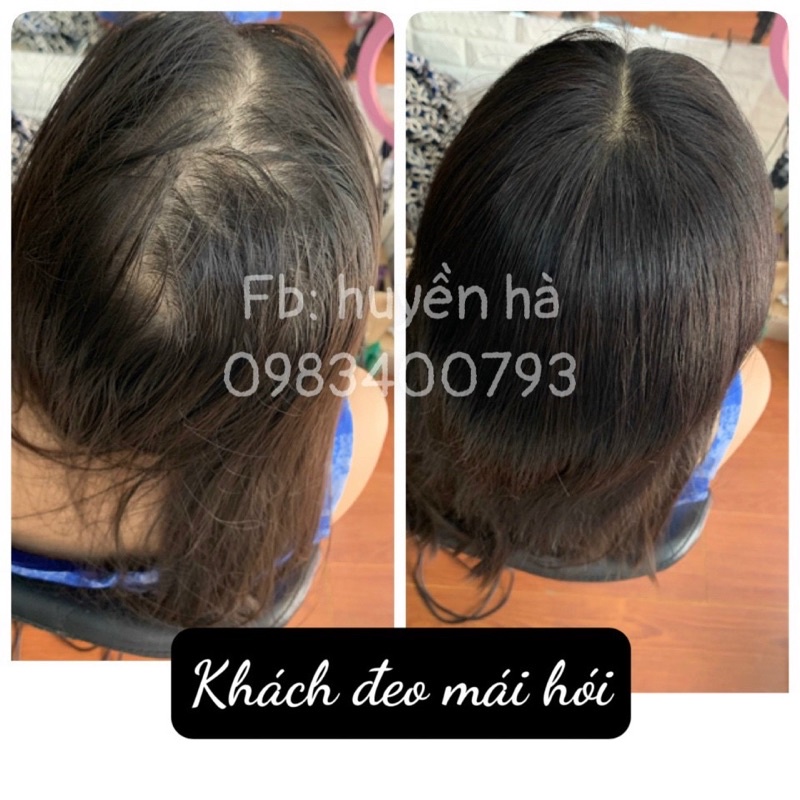 PHỦ HÓI SIÊU DA 3D TỪ TÓC THẬT