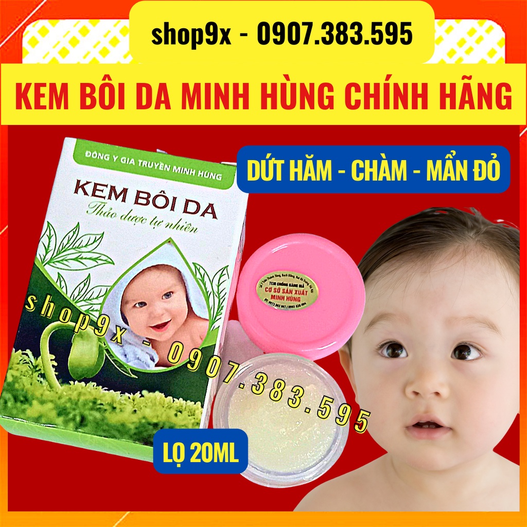 Kem Bôi Da Minh Hùng Chính Hãng - Kem Dưỡng Ẩm Da Bé // Shop9x