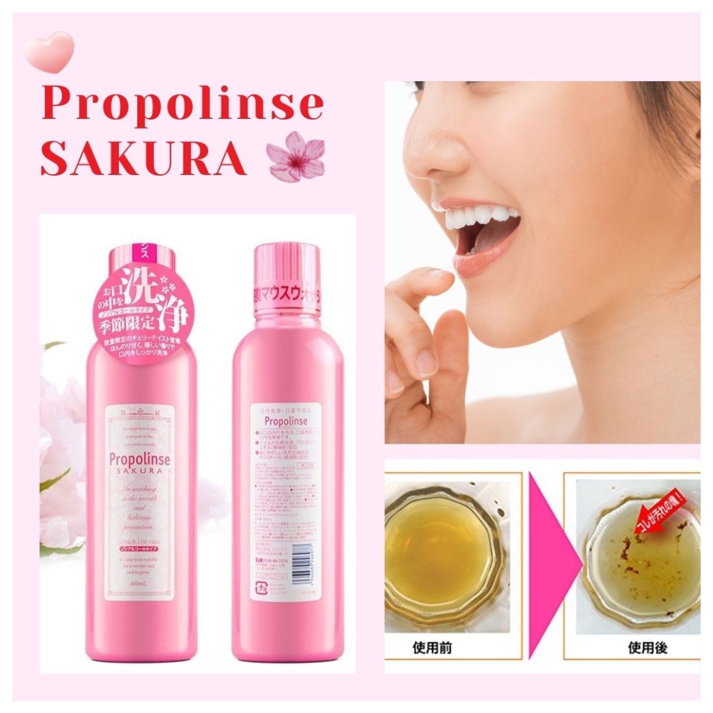 Nước súc miệng Propolinse Nhật Bản 600ml