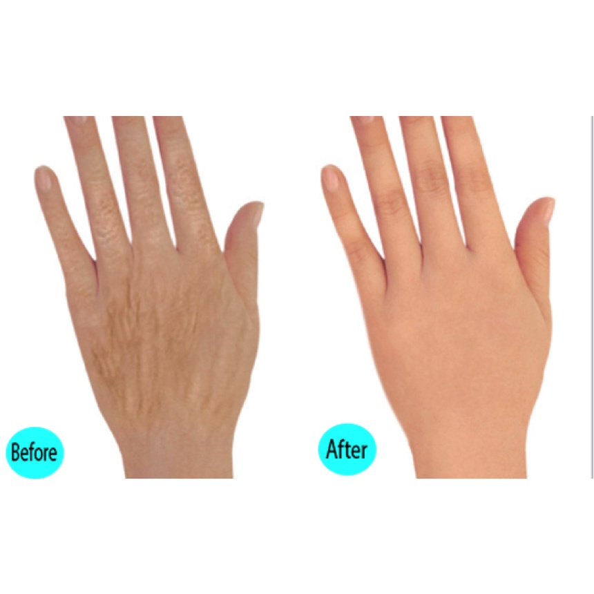 Kem dưỡng da tay💖FREESHIP💖giảm nhăn giảm gân tay chống lão hóa tay