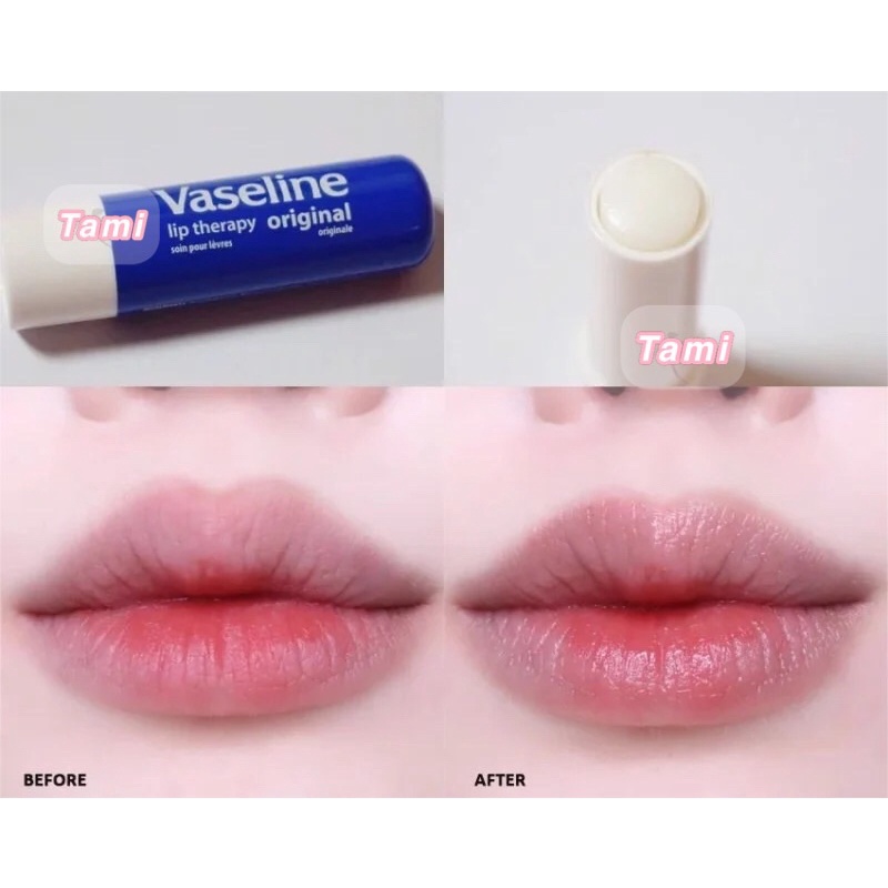 Son Dưỡng Vaseline Lip Therapy/ Sáp Dưỡng Vaseline Healing Jelly