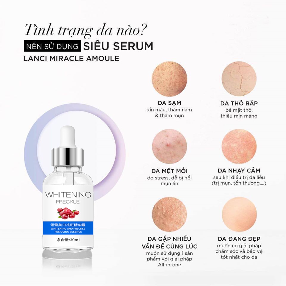 Tinh chất làm trắng 30ml tinh chất trắng da Nicotinamide làm trắng da mặt sáng da dưỡng ẩm chống lão hóa serum làm trắng