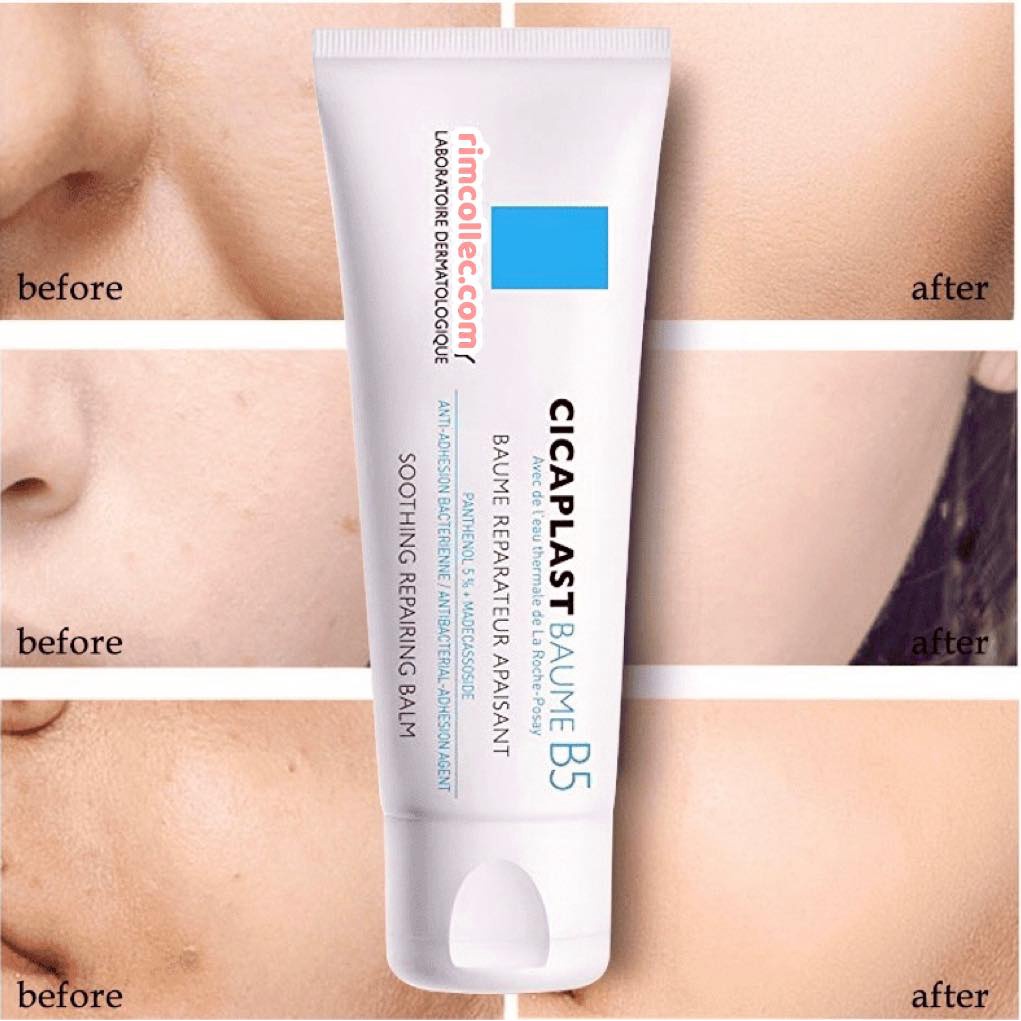 Kem dưỡng phục hồi da La Roche-Posay Cicaplast Baume B5