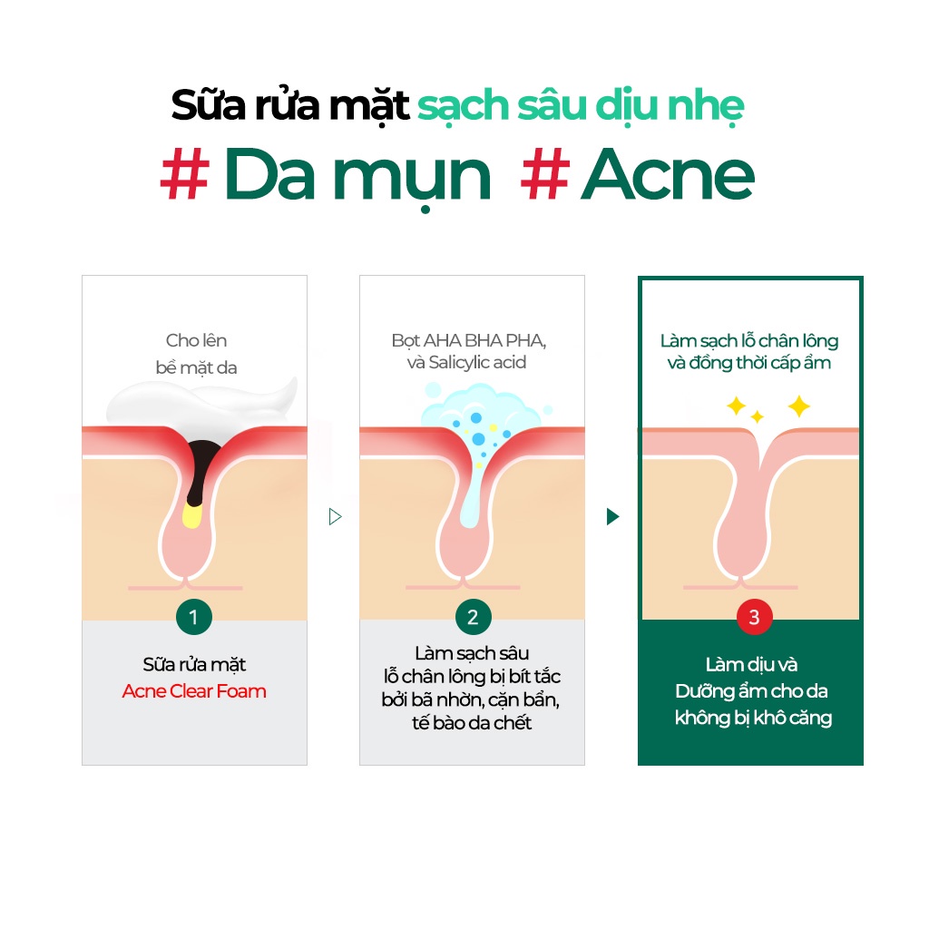 Set sữa rửa mặt và sữa tắm làm sạch sâu Some By Mi Miracle Acne Clear Foam &amp; Body Cleanser
