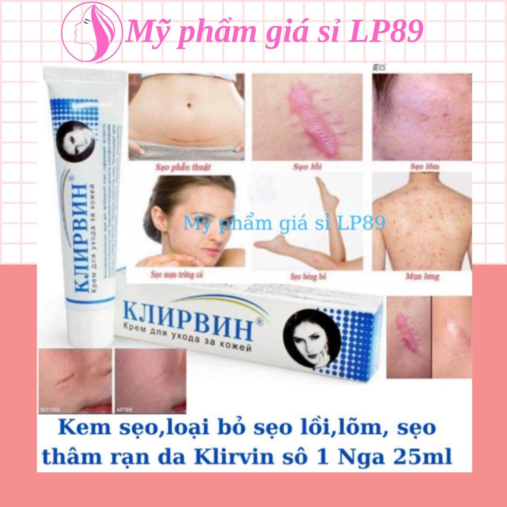 Kem mờ sẹo,kem loại bỏ sẹo lồi, lõm,thâm rạn da chỉ trong 2 tháng cam kết hàng cao cấp số 1 Nga)