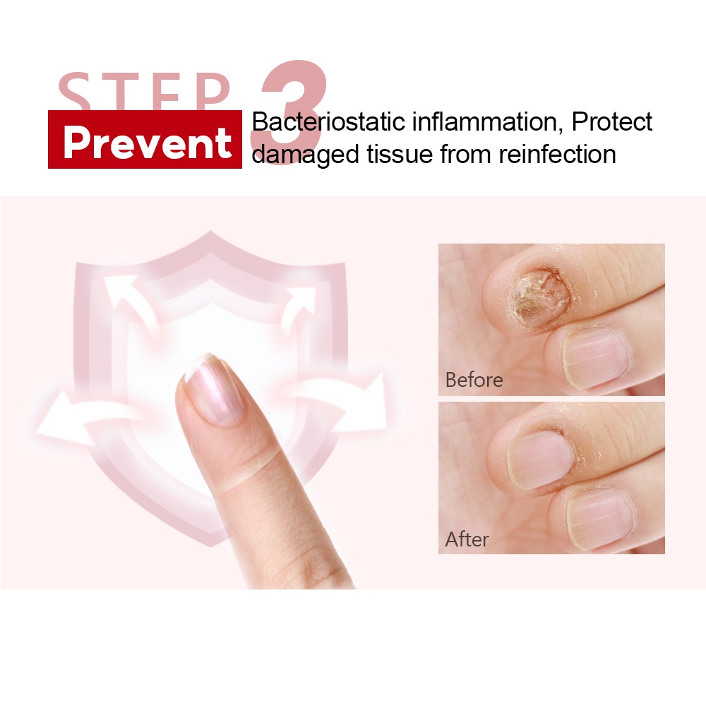 Kem phục hồi móng tay VIBRANT GLAMOUR hỗ trợ giảm nấm làm mềm/ phục hồi móng tay/ chân chuyên dụng 20g