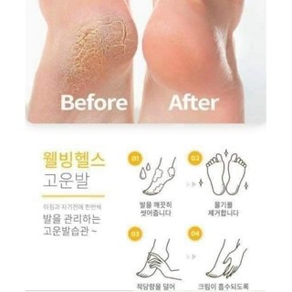 Kem nứt gót chân Hàn Quốc tuýp 60gram