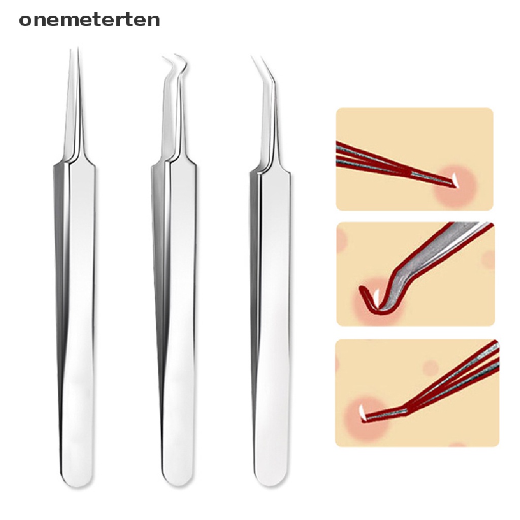 Nhíp Đầu Nhọn Lấy Nhân Mụn Đầu Đen Chăm Sóc Da Mặt