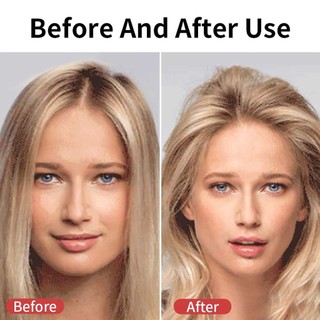 Kẹp Uốn Phồng Chân Tóc Hàn Quốc
