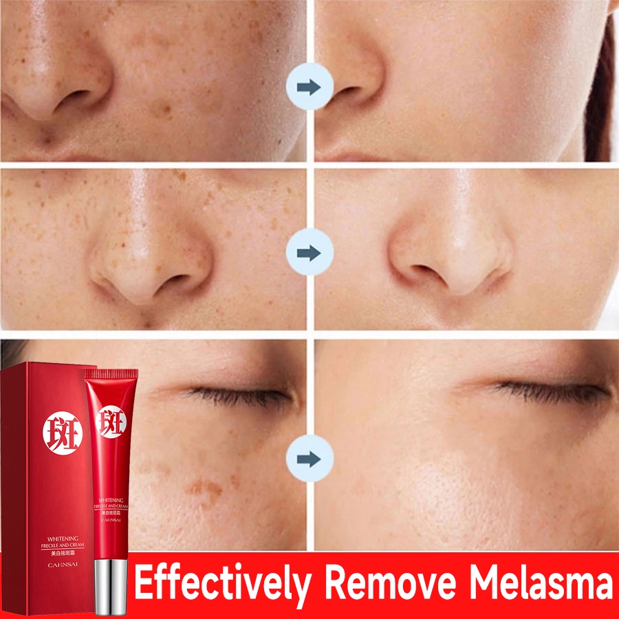 Kem Hỗ trợ giảm tàn nhang Làm Trắng Da Và Phục Hồi Làn Da 20g