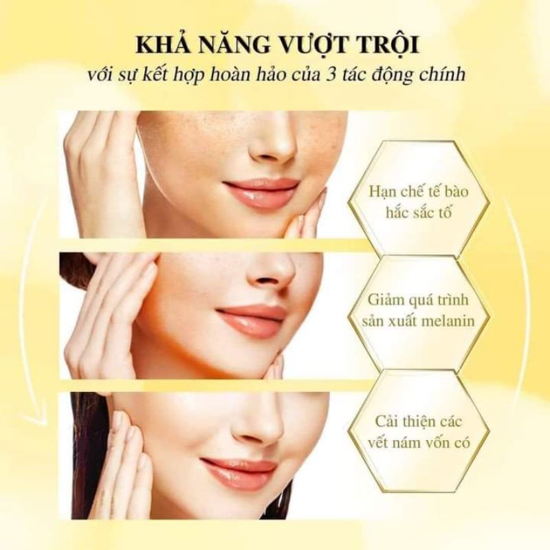 CAO NÁM MAGIC SKIN cao nám Royal Melasma Plus ngừa nám tàn nhang