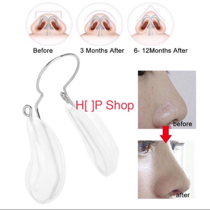 Kẹp nâng mũi cao cấp Nhật Bản