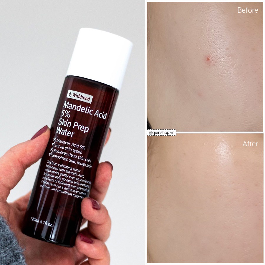 Tẩy Da Chết Sáng Da By Wishtrend Mandelic Acid 5% Skin Prep Water