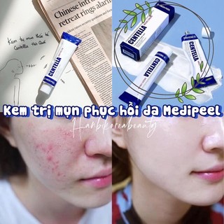 Kem ngừa mụn medipeel