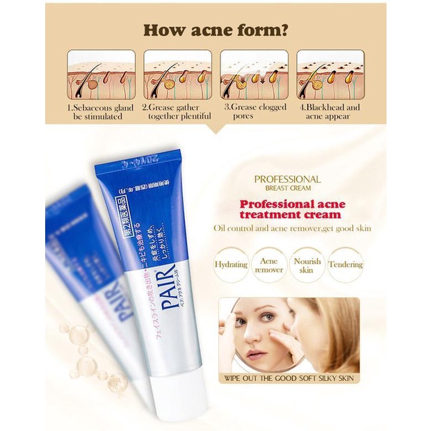Kem Giảm Mụn Chuyên Biệt lion pair acne cream 24g acne derm