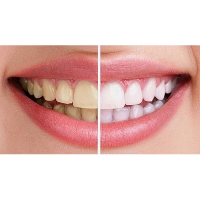 Bột Trắng Răng Nga trắng men răng, sạch mảng bám, thơm miệng