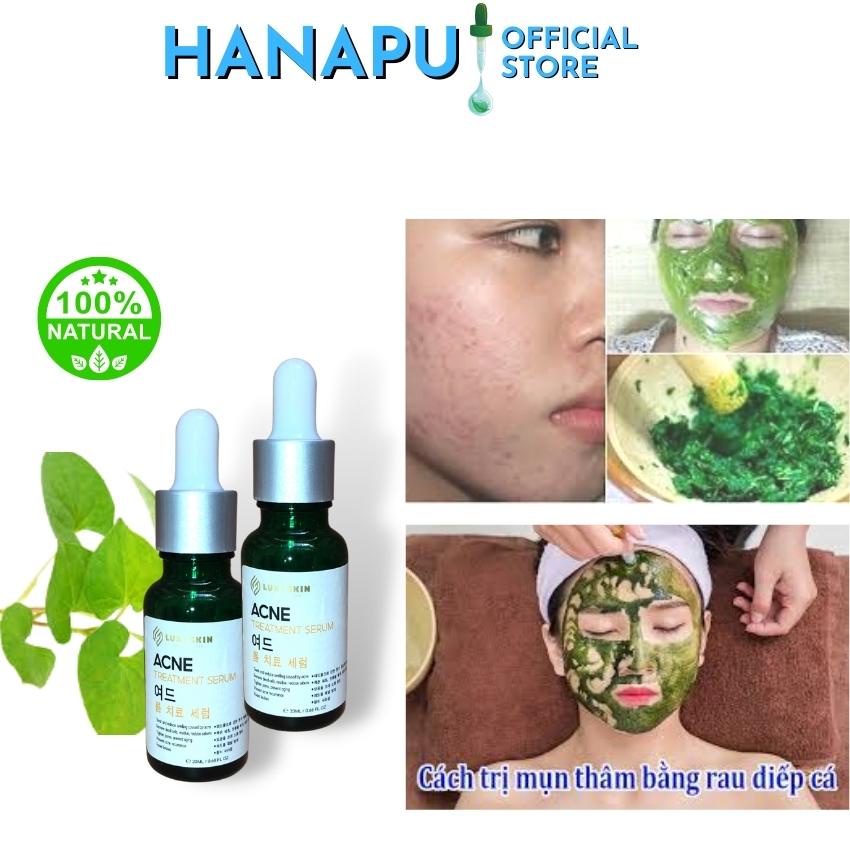 Serum mụn phục hồi da hư tổn se khít lỗ chân lông giảm thâm giảm m️ụn giúp da căng bóng và làm đều màu NUTIPU 20ml