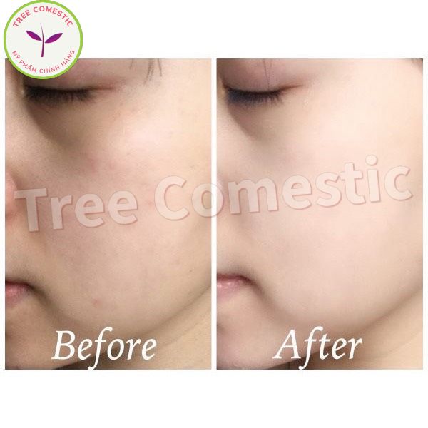 Kem Dưỡng Trắng Da Mặt Và Cơ Thể Face & Body 5% Niacinamide Emulsion 250ml