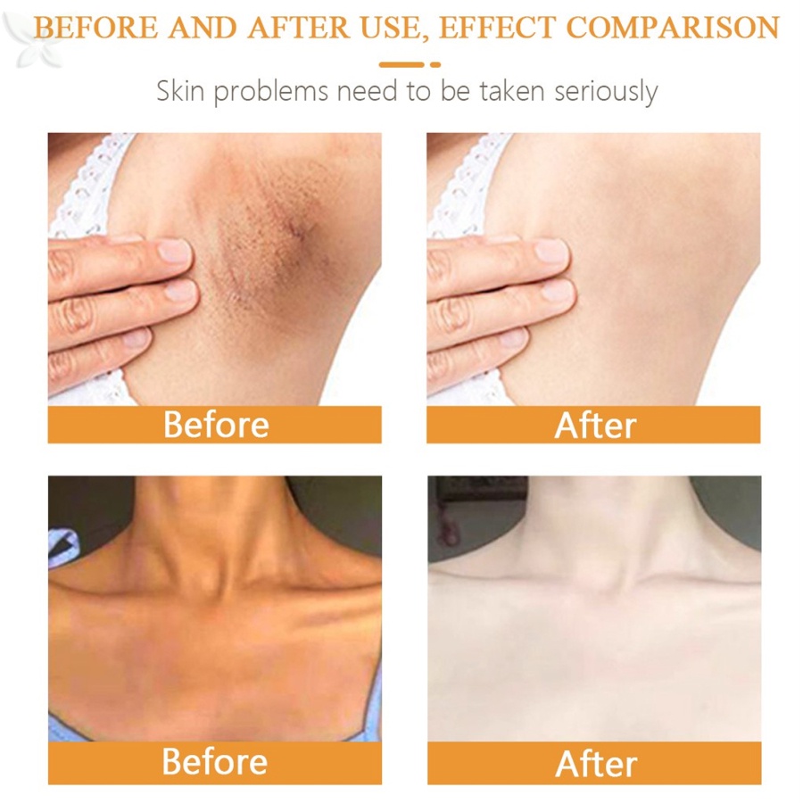 Kem Làm Trắng Vùng Da Dưới Cánh Tay / Đầu Gối / Khủy Tay / Chân Dưỡng Ẩm Làm Trắng Sáng Da JMMZ SODSNIE