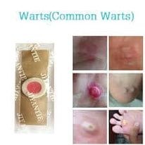 Miếng dán mụn cóc loại bỏ á sừng và mụn cóc tay chân