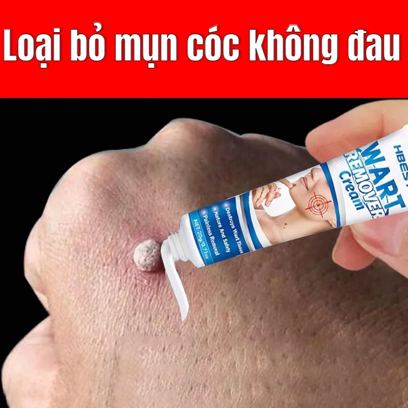 Kem tẩy mụn cơm Tẩy nốt ruồi miếng dán mụn cóc mụn thịt tàn nhang sẹo lồi An toàn Nhanh Có hiệu quả 20g