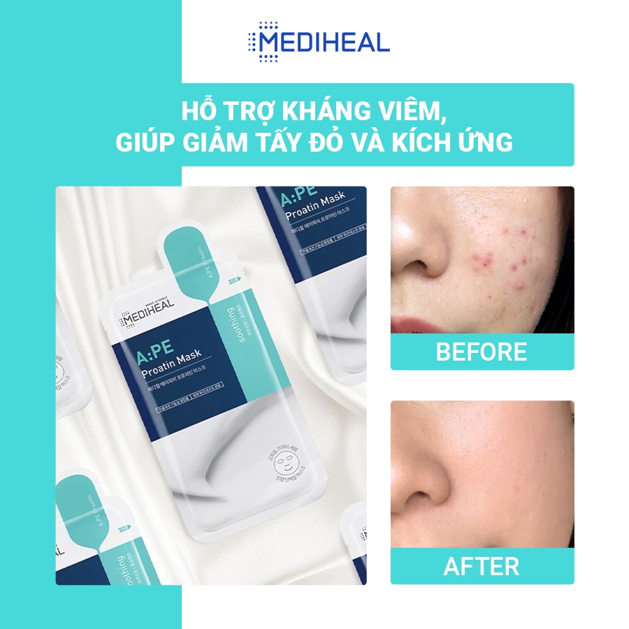 Mặt Nạ Giảm Viêm- Kích Ứng Da Mediheal A:PE Proatin Mask 25ml [K22]