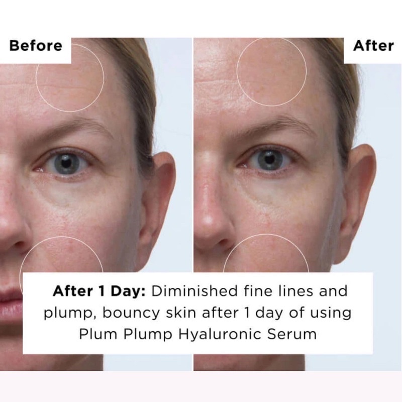 Serum tinh chất dưỡng ẩm Plum Plump Hyaluronic