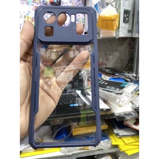 Ốp lưng Xiaomi Mi11 Ultra dẻo silicon viềng lưng nhựa trong