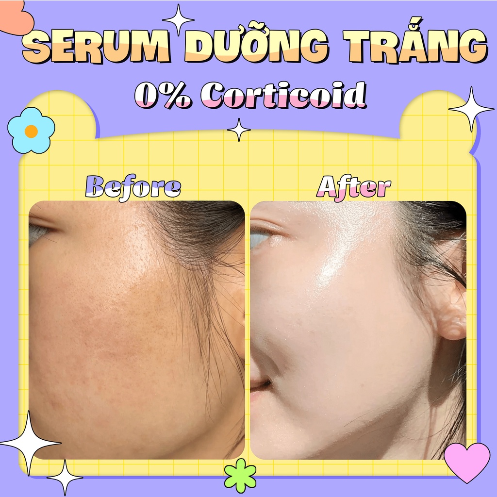 Serum Trắng Sáng Mờ Thâm Ngừa Mụn GUO 30ml