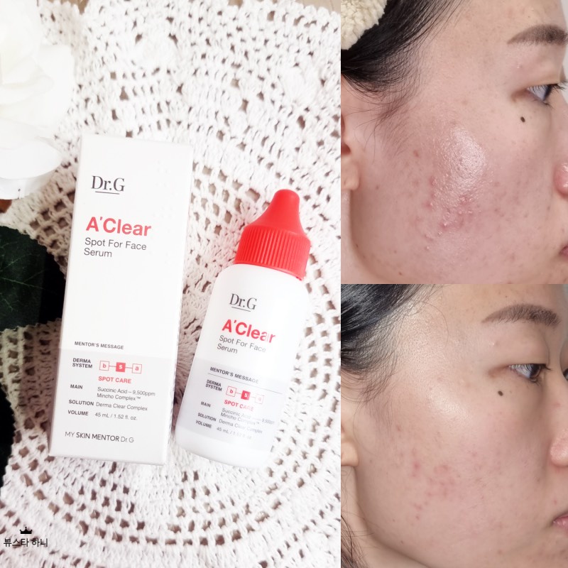 Serum giảm mụn viêm Dr.G A'Clear Spot For Face Serum