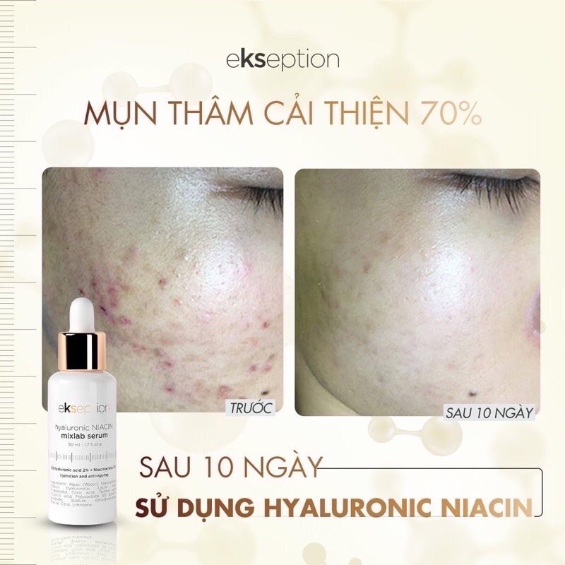 [Cty] Tinh chất dưỡng sáng, giảm thâm mụn Ekseption Hyaluronic Niacin chứa 5% Niacinamide