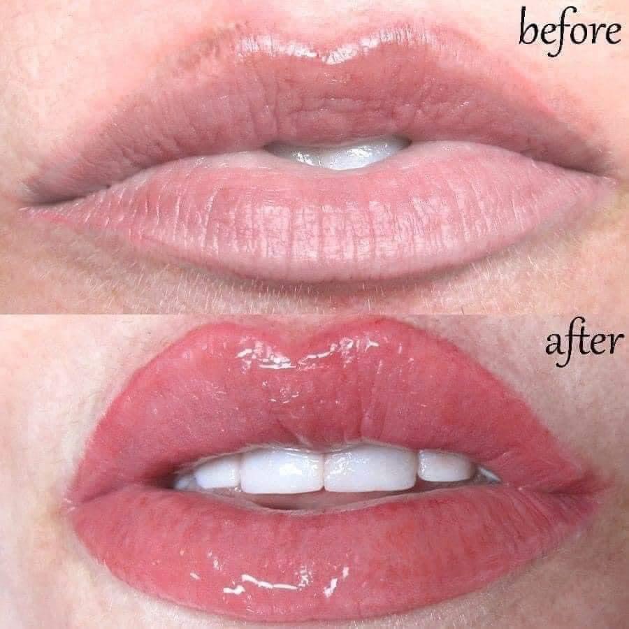 Son dưỡng môi Choosy Lips Treatment Nhật bản