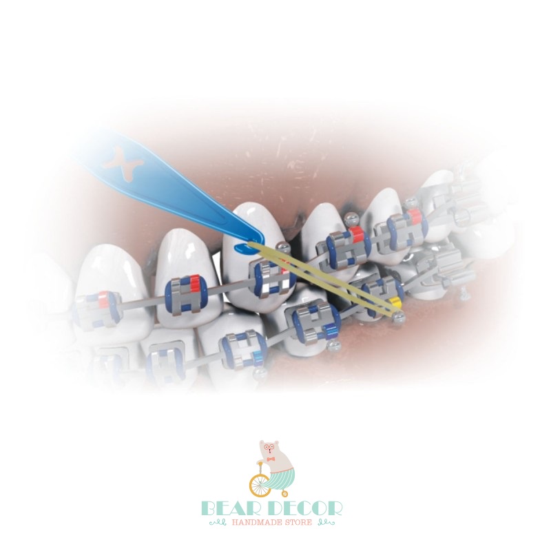 Thun Liên Hàm, Chun Chỉnh Nha, Niềng Răng Gói 100 Cái