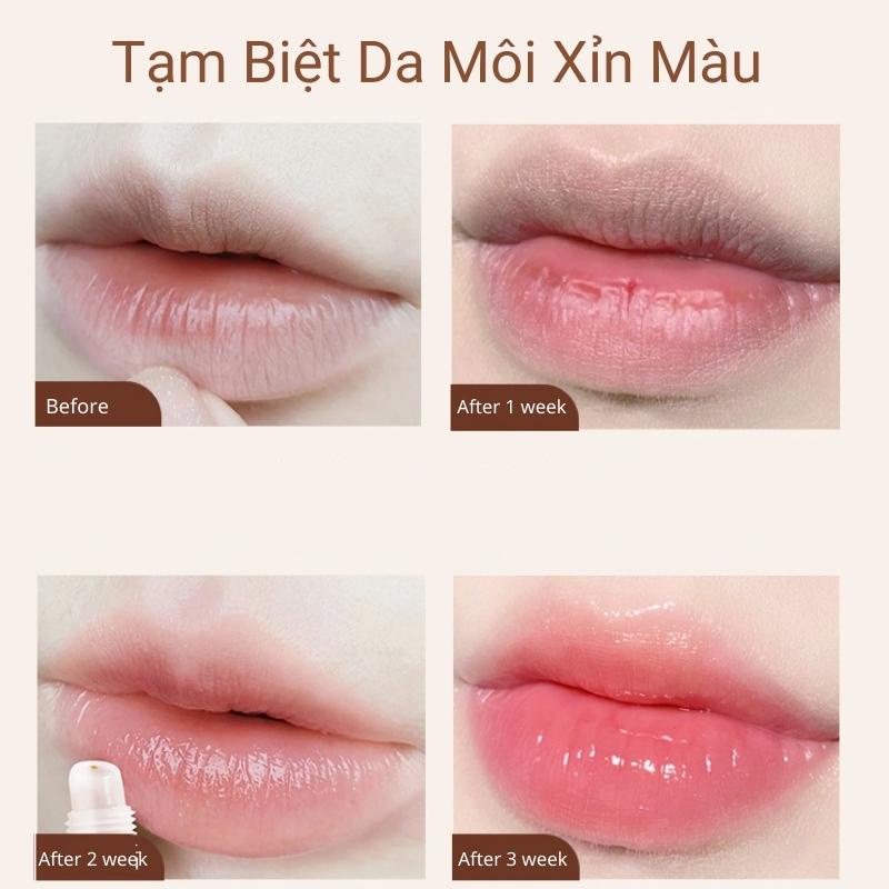 Kem Tẩy Tế Bào Chết Da Môi Heyxi Chính Hãng Loại Bỏ Tế Bào Da Chết Bổ Sung Vitamin E Giúp Môi Căng Bóng Mịn Màng