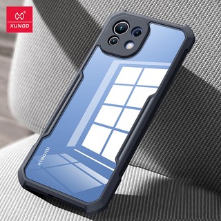 Ốp lưng xundd xiaomi mi 11 lite - chống sốc