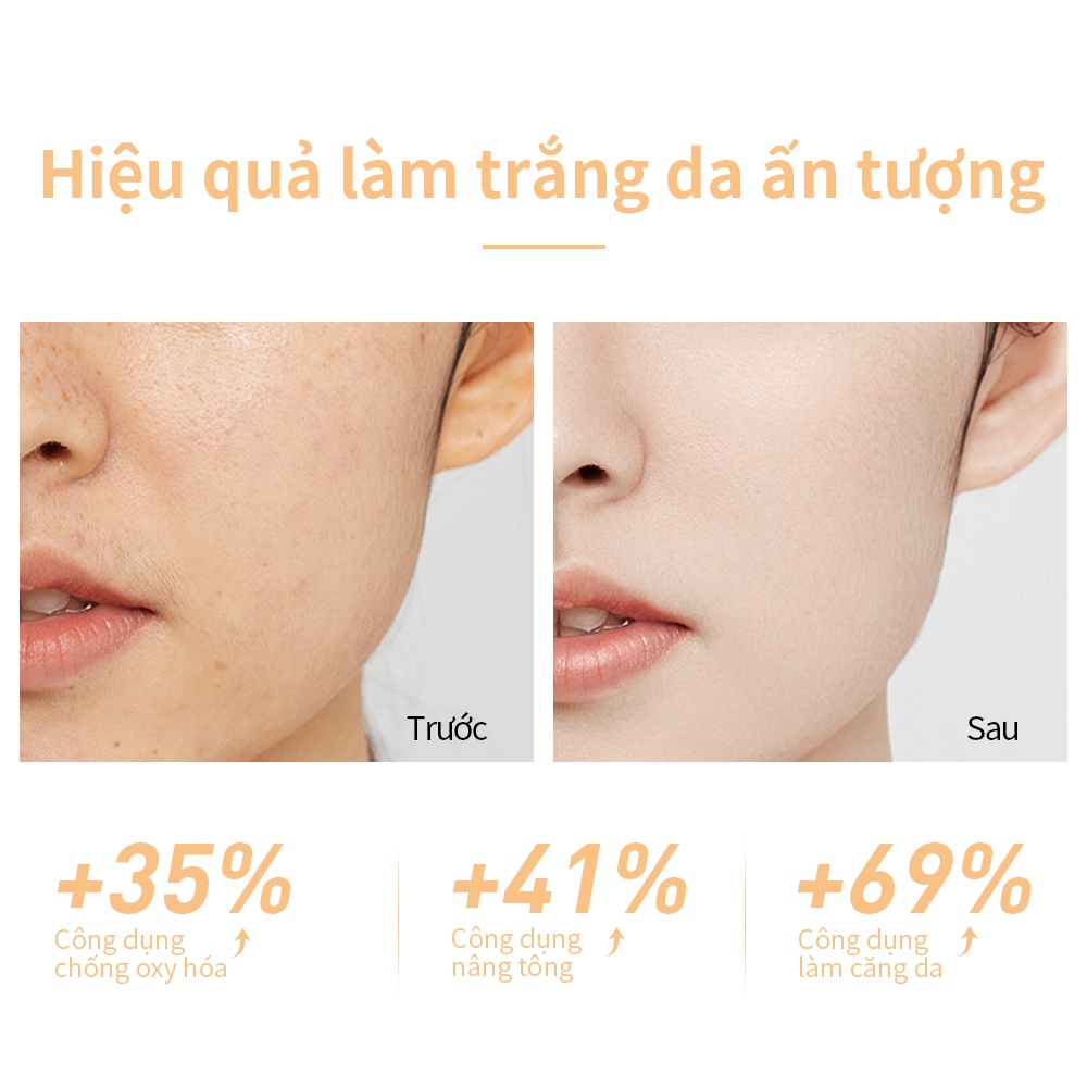 [2PCS] Bộ Serum Lanbena Niacinamide Dưỡng Sáng Da Dưỡng Ẩm Săn Chắc Da (30g + 15ml)