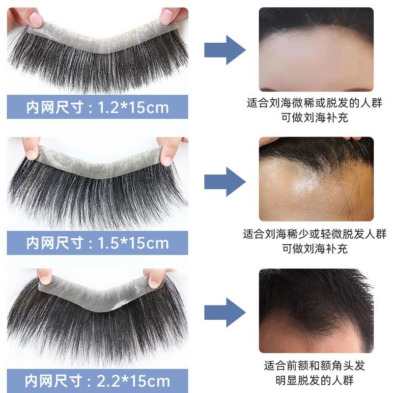 Tóc Giả Vô Hình Không Đường May Dán Tóc Mái Ngang Trán Cho Nam