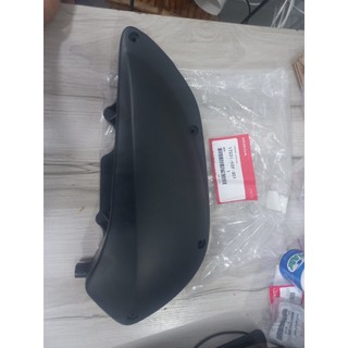 Chụp pô e Sh Ý 150