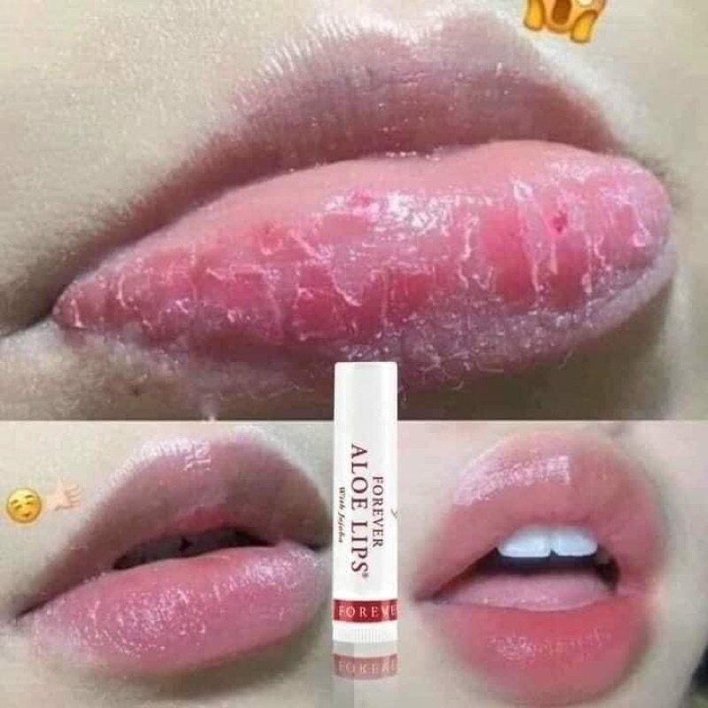 SON DƯỠNG MÔI FOREVER ALOE LIPS WITH JOJOBA 4,25g