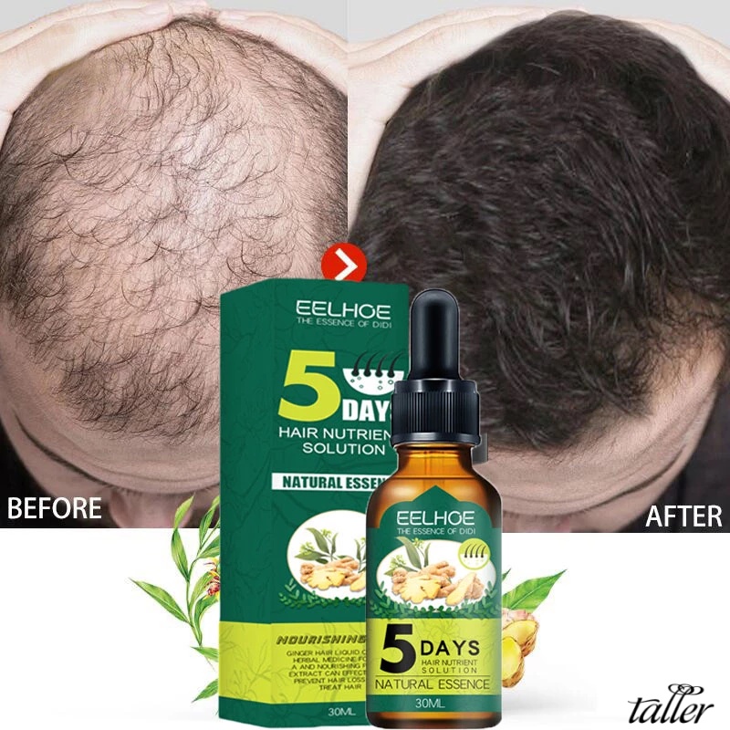 ✧Ready Stcok Eelhoe Gừng Mọc Tóc Sản 5 Ngày Tự Nhiên Chống Rụng Tóc Tinh Dầu Nhanh Phát Triển Nuôi Dưỡng Da Đầu Khô Bị Hư Hại Điều Trị Chăm Sóc Tóc