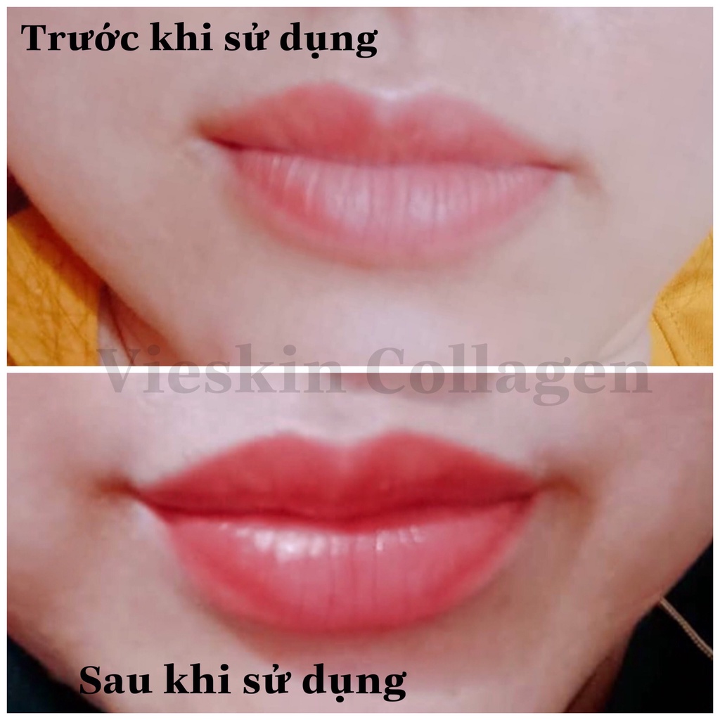 Tinh chất dưỡng kích màu môi sau phun xăm Vieskin GoldShine, collagen tươi kích màu sắc nét, tự nhiên, căng bóng, 7ml