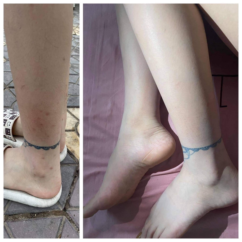 [THANH LÝ MÓP VỎ HỘP] TINH DẦU XÓA THÂM PHÚC MINH KHANG | BigBuy360 - bigbuy360.vn