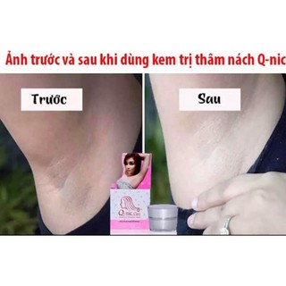 KEM GIẢM THÂM NÁCH QNIC
